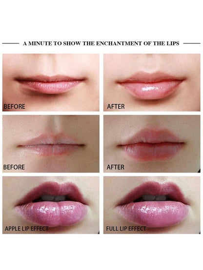 Electric Lip Plumper